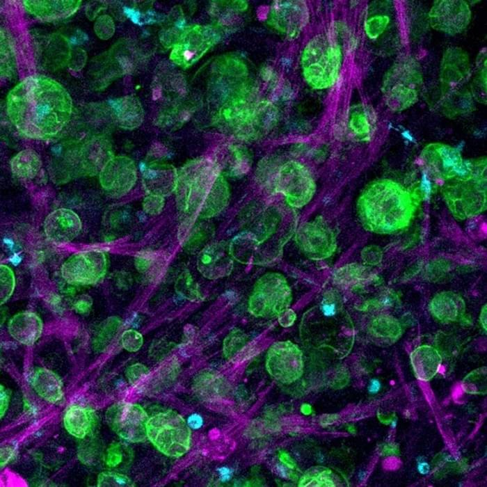 Triple-Culture-of-Pancreatic-Ductal-Adenocarcinoma-Cells.jpg