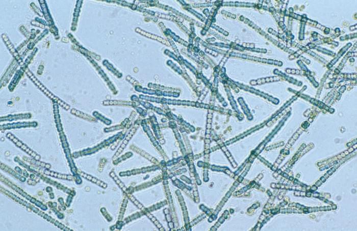 1600px-CSIRO_ScienceImage_4203_A_bluegreen_algae_species_Cylindrospermum_sp_under_magnification.jpg