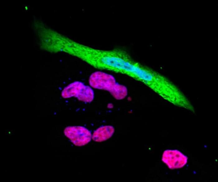 Suppression-of-NLRC5-in-SARS-CoV-2-Infected-Cells-777x648.jpg