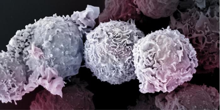 Electron-Microscope-Image-of-T-Cells-777x389.jpg