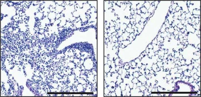 SLR14-Reduces-Pneumonia-COVID-777x377.jpg