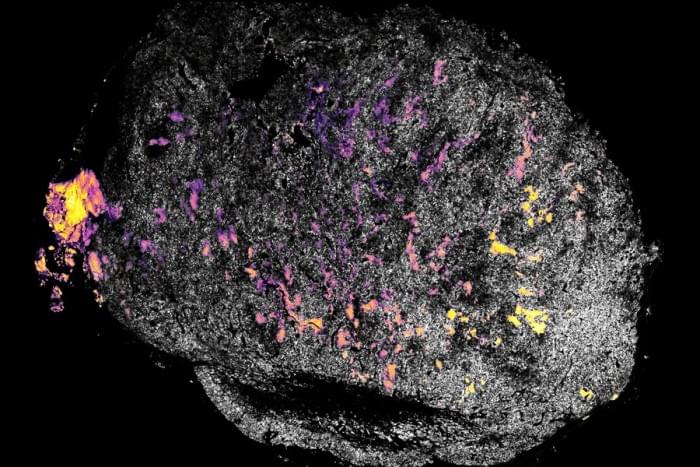 MIT-Cancer-Cytokine-01-press_0.jpg