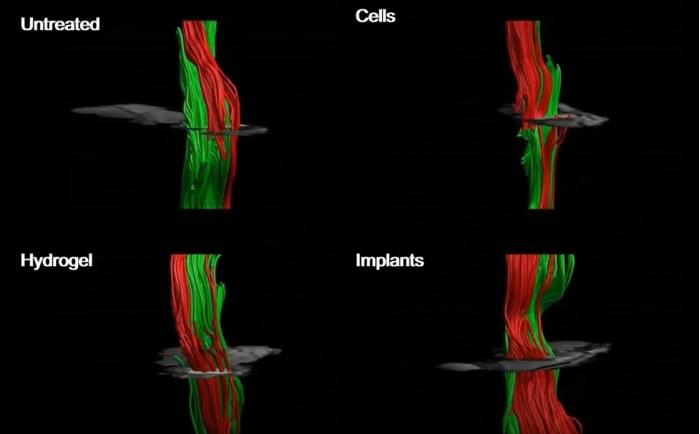 Injured-Spinal-Cord-With-and-Without-Treatment.jpg