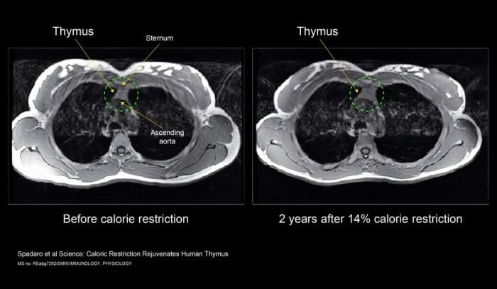 thymus_mri-cr-large.jpg