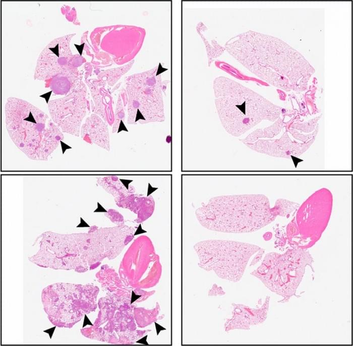 C26-Suppresses-Metastasis.jpg