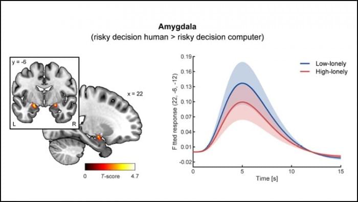 Loneliness-Social-Anxiety-Amygdala-Activity.jpg