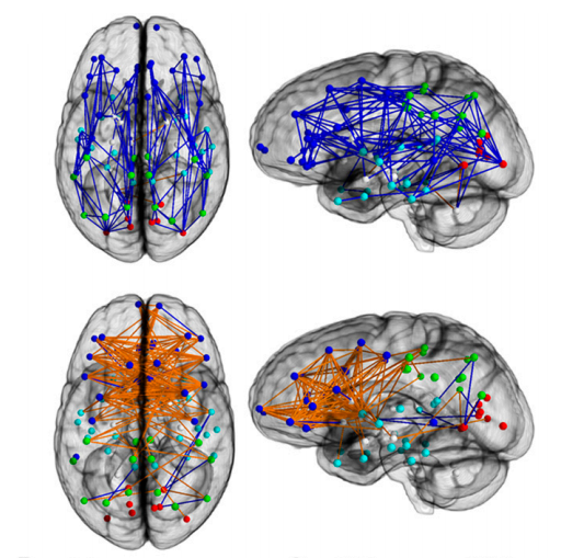 蓝色为男性脑部的前后连接情况；橙色为女性大脑的左右连接情况