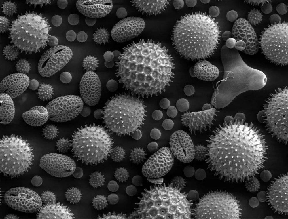 花粉粒在显微镜下的形态各不一样 图/wikipedia<br label=图片备注 class=text-img-note>