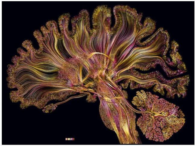 图｜大脑彩色图像（来源：Greg Dunn 博士）<br>