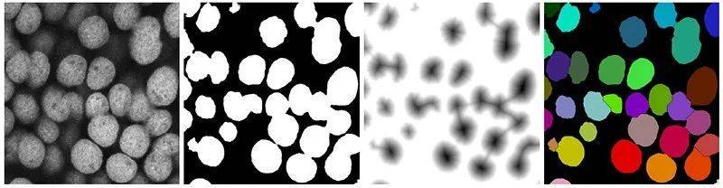 在插件的帮助下，ImageJ 工具可以自动识别显微镜图像中的细胞核。| Ignacio Arganda-Carreras / ImageJ