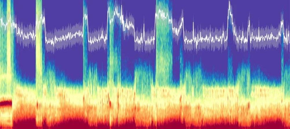 受试者晚间的大脑频谱图，白线表示波谱斜率变化，与受试者的睡眠清醒程度相对应。