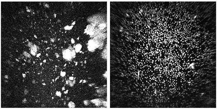默沙东公司关于K药的纯化与结晶试验的地面对照样品（左）和航天样品（右）的UV成像，