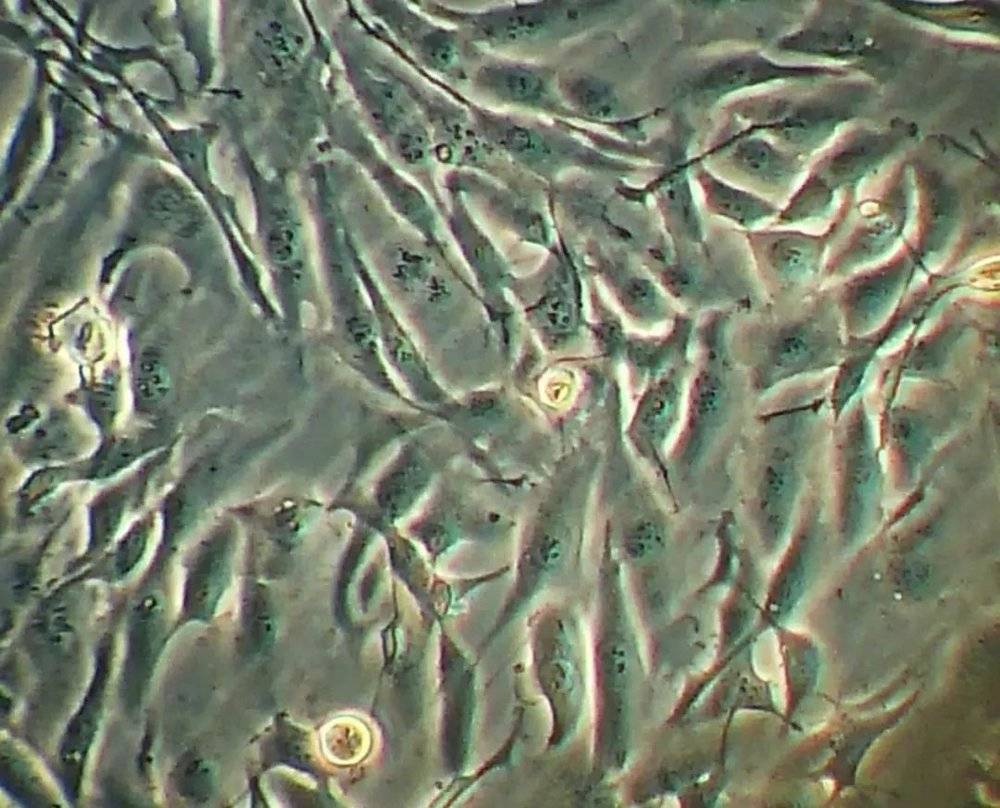 这是被送上太空的滤泡甲状腺细胞。这些癌细胞将在国际空间站的微重力环境中进行研究。