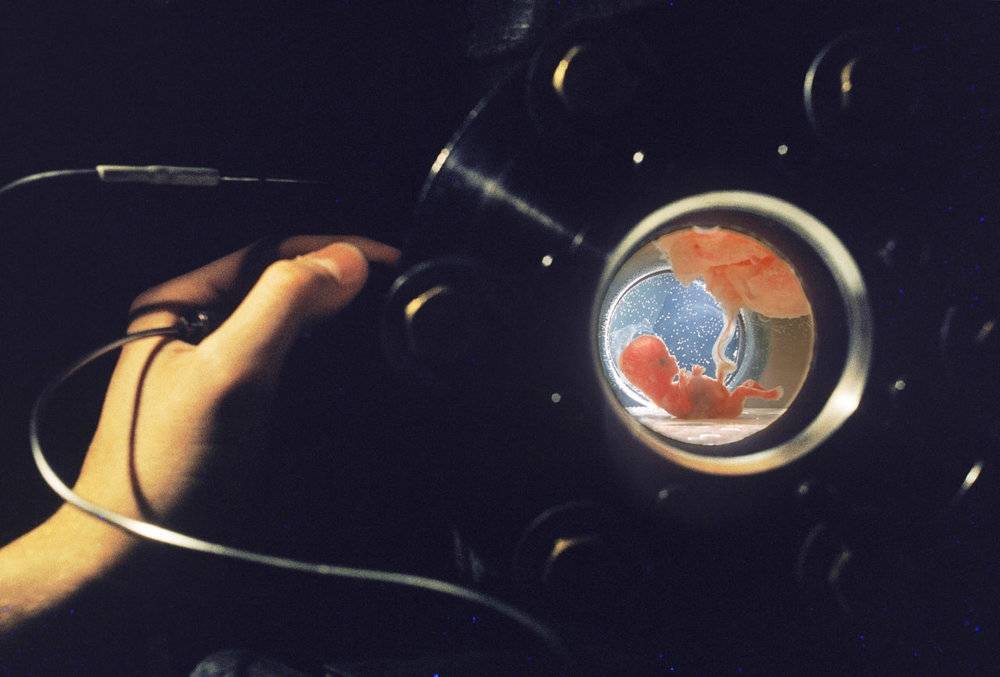 1965 年斯坦福大学医学院实验中人造子宫中的人类胎儿:左手调节阀门，改变加压流体中的营养水平，加压流体通过皮肤呼吸向胎儿输送氧气<br>