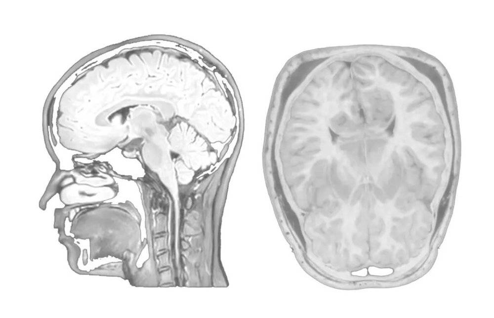 TCCI出品纪录片《打开思想的大门》中脑神经影像图<br>