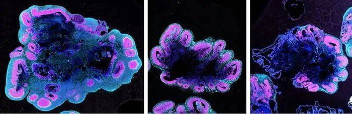 人脑类器官生长得比大猩猩和黑猩猩的大脑类器官大得多（从左至右），这些大脑类器官显示的是5周时的大小。图片来源：S.Benito-Kwiecinski/MRC LMB/Cell