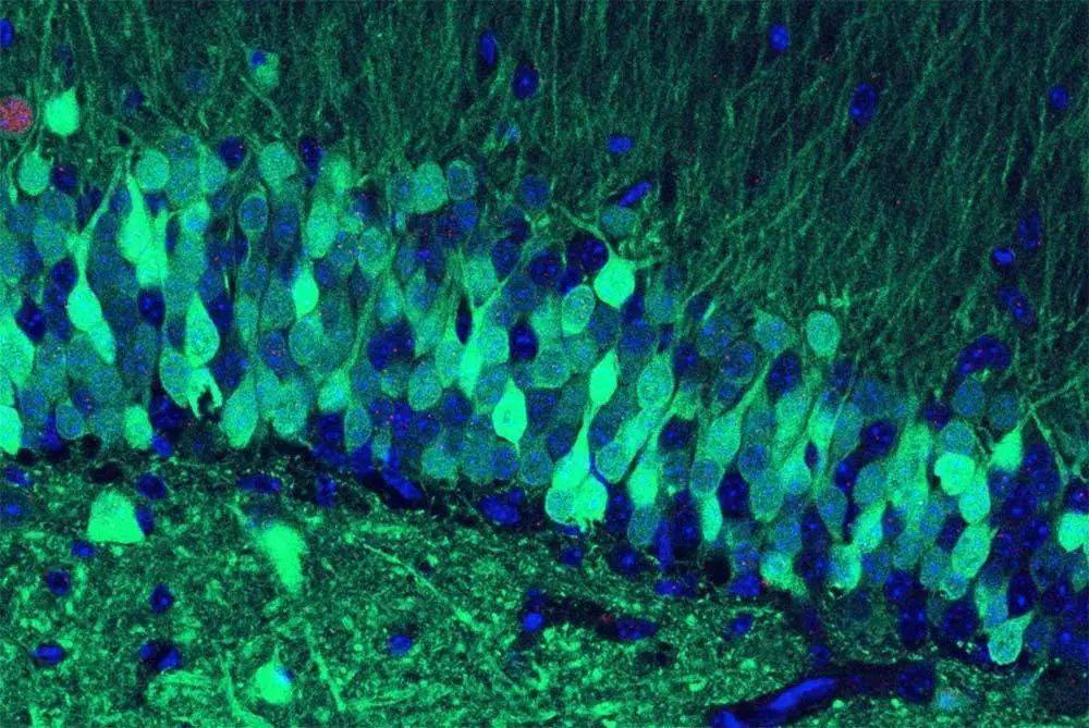 图中发出绿色荧光的细胞表明，它们是在小鼠的大脑存储恐怖记忆时激活的。图片来源：Stephanie Grella and the Ramirez Group at Boston University