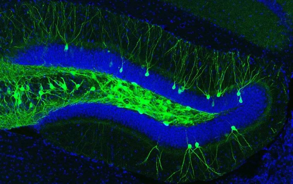 早期阿尔茨海默病小鼠模型的海马齿状回的冠状切片，在光遗传技术的结合下，情境性恐惧记忆下的记忆印迹细胞（绿色）被光敏蛋白ChR2标记。图片来源：Dheeraj Roy