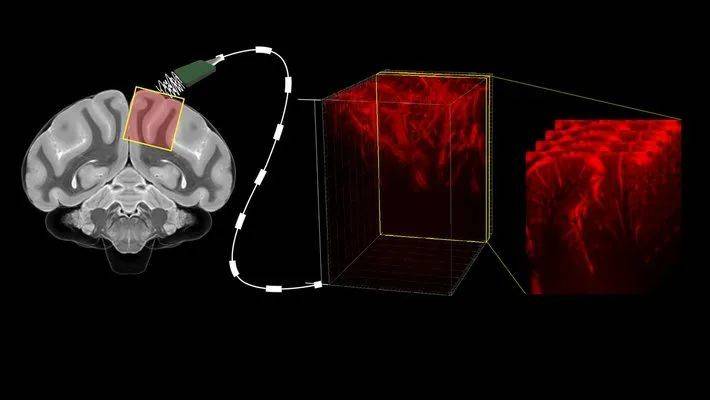陈天桥雒芊芊脑机接口中心团队研发了一种新型微创脑机接口，使用了功能性超声技术准确地绘制大脑深处精确区域的大脑活动图<br label=图片备注 class=text-img-note>