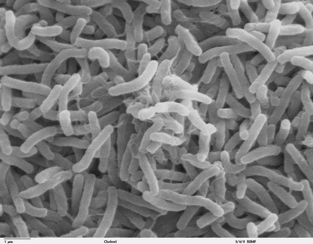 显微镜下的霍乱弧菌丨 Wikimedia Commons, Public domain