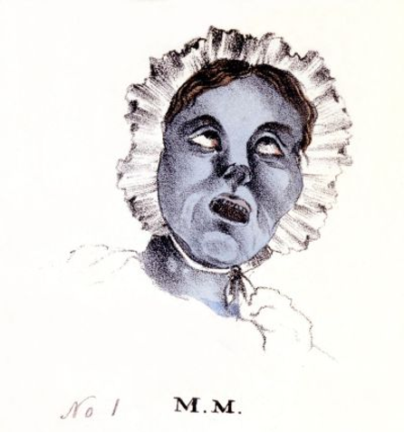 1832年的一位纽约霍乱病患（来源：纽约市历史协会）<br label=图片备注 class=text-img-note>