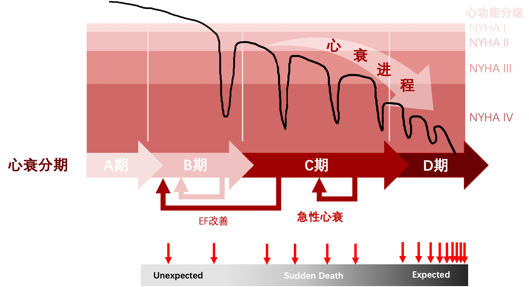 图4.  心衰进程与心脏性猝死发生率相关：随着心衰进展从初期（A、B期或NYHA II）进展到中、终末期（C、D期或NYHA III、IV期）猝死的发生率与概率越来越高（下方红色箭头示意猝死频次）<br label=图片备注 class=text-img-note>