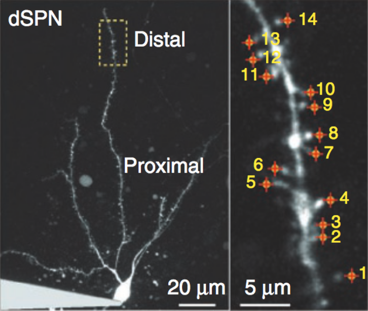 图6. 在纹状体多刺投射神经元SPN 中填充荧光蛋白后，便可看到它的“脚”上有很多像“刺”一样的突起（右图数字所标）<sup>[16</sup><sup>]</sup>。（注意：右图是左图中黄框内的部分）