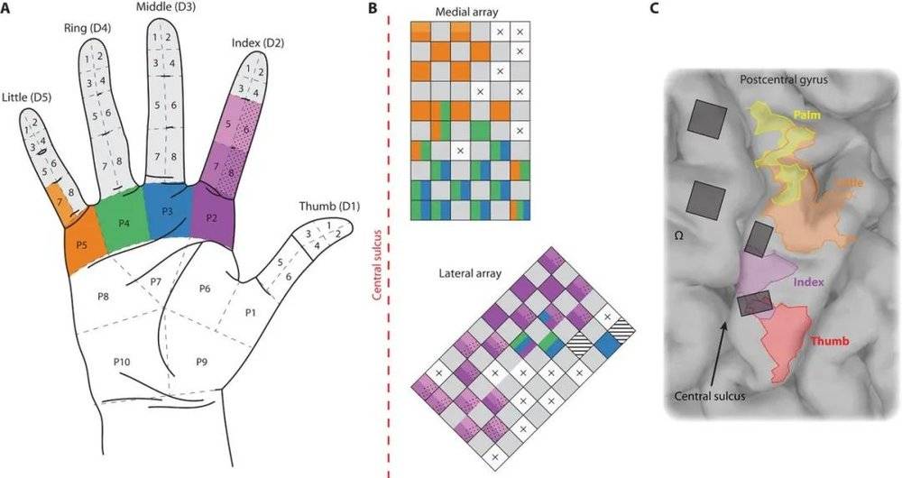 图3  用多个电极产生虚拟感觉  A 把假手的每个手指分成八个区域（1-8），把每个区域的压力传感器信号转化成电流通进一个电极。这样假手上不同位置的不同压力就能转化成对不同神经细胞的不同发放频率，以产生虚拟感觉。B 电极植入脑皮层的位置示意图，虚线代表脑皮层上的主要地标“中央沟”，中央沟后面就是身体感觉的手区。C 病人脑皮层上实际的感觉区与电极的相对位置。浅黄色为手掌感觉区，橘黄为小指区，淡紫色为食指区，红色为拇指区。灰色方块为电极阵的位置。从图中可以看出，植入电极的范围虽然远比手感觉区小，而且手指手掌的位置也和感觉区对不上。但是通过手眼结合的训练，病人逐渐能学会，产生逼真的虚拟感觉。（图源：Flesher et al., Sci. Transl. Med. 8, 361ra141 (2016) ）<br>
