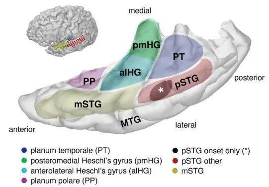 人脑左半球听觉皮层的位置和分区示意图（图片来源：参考资料[1]）<br>