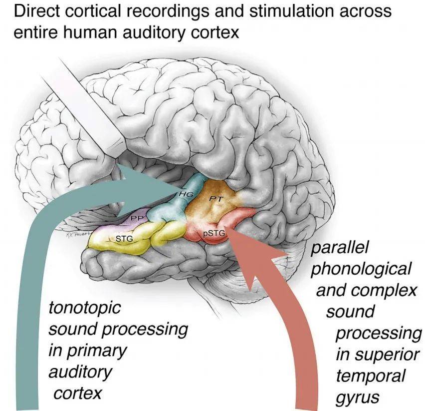 通过电极直接记录信号和给予刺激发现语音信息处理的并行通路（图片来源：参考资料[1]）<br>