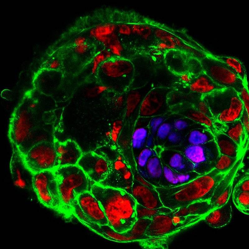 受精十天后实验室培养的人类胚胎，显示将成为胎儿的细胞呈紫色。图片来源：剑桥大学<br>