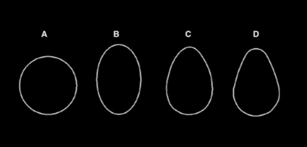  蛋的四种基本形状：(A)球形，(B)椭球形，(C)卵球形，(D)梨状。| 图片来源：Narushin et. al. / Annals of the New York Academy of Sciences<br label=图片备注 class=text-img-note>