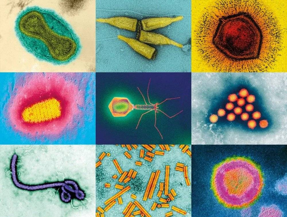 图示不同形状、大小的病毒，如巨型拟菌病毒（右上）、登月器形状的噬菌体（中心）。图源：伪色电子显微照片（比例尺不一致）。首行左至右：天花病毒、酸菌瓶状病毒、拟菌病毒。中间行左至右：狂犬病病毒、T4噬菌体、轮状病毒。末行左至右：埃博拉病毒、烟草脆裂病毒、HIV-2病毒。SPL; M. Häring<em> et al./J. Virol.</em>; E. Ghigo<em> et al./PLOS Patho</em><em>g</em>.; Frederick A. Murphy/CDC Global<br>