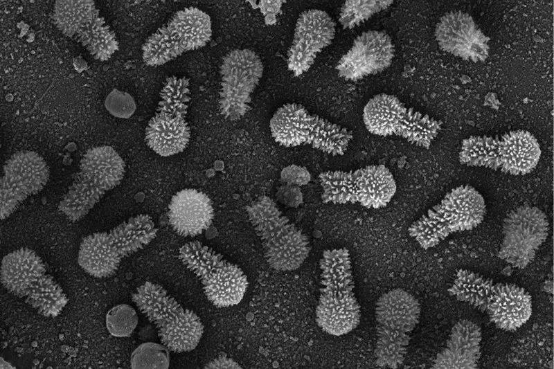 图为巨型病毒图邦病毒（tupanvirus），在阿米巴变形虫身上发现，长1000多纳米，其编码基因是已知病毒中最大的。图源：J. Abrahão <em>et al./Nature Commun.</em><br>