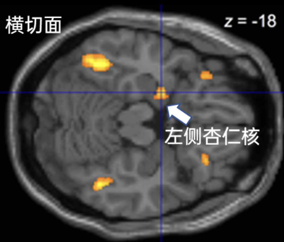 图 | 参考文献[3] ，汉化：作者