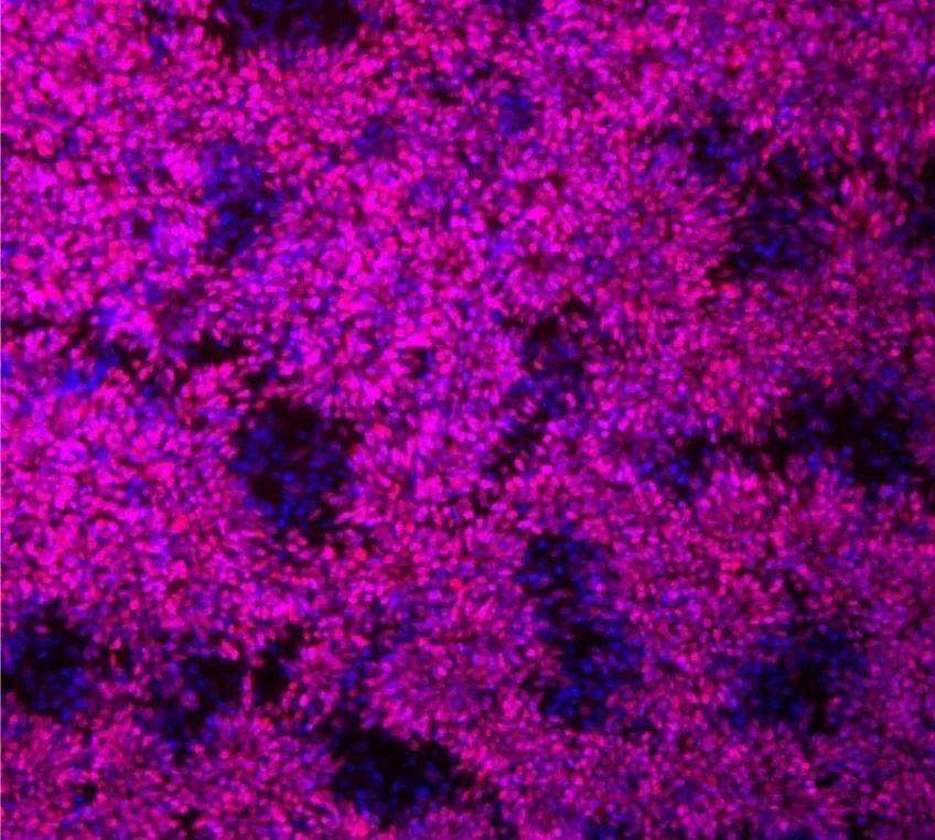  取自于黑猩猩的神经干细胞。｜图片来源：Johan Jakobsson via Lund University<br>