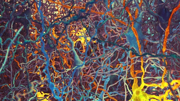 大鼠新皮层中不同类型的神经元缠结的数据可视化图像丨图片来源：Nicolas Antille, EPFL.<br>