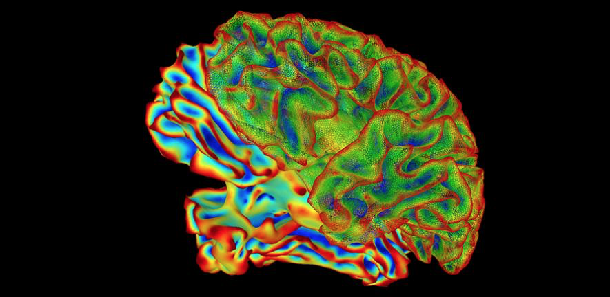  剑桥大学的研究人员首次利用人类数据，量化了能够导致阿尔茨海默病的不同过程的速度。他们发现，阿尔茨海默病不是从大脑中的单个点开始，再引发导致脑细胞死亡的连锁反应的；而是在早期就抵达了大脑的不同区域。| 图片来源：National Institute of Mental Health, National Institutes of Health
