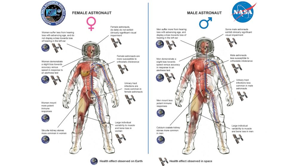太空对男性和女性身体的不同影响。<br>