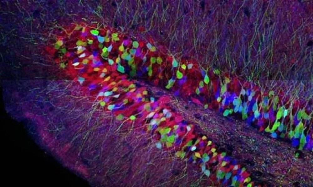 ▷ 海马体中的神经元，图片来源: Dr. Curtis Cripe NTL Group<br label=图片备注 class=text-img-note>