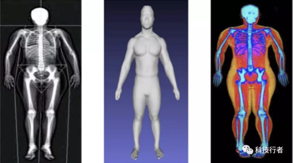 图10. AI分析3D光学图像，测量脂肪、肌肉、骨骼等人体构成<br label=图片备注 class=text-img-note>