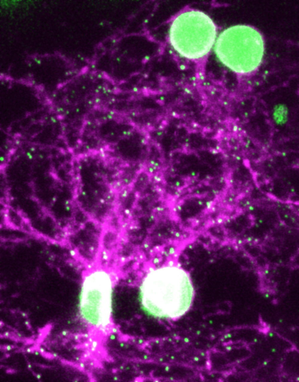 这张图片显示了活着的斑马鱼脑中的神经元，其中突触被涂成了绿色。| 图片来源：Zhuowei Du and Don B. Arnold, CC BY-NC-ND<br label=图片备注 class=text-img-note>