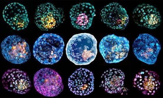 这些模拟囊胚阶段的胚胎细胞，是由皮肤细胞重新编程而来。来源：Monash University<br label=图片备注 class=text-img-note>