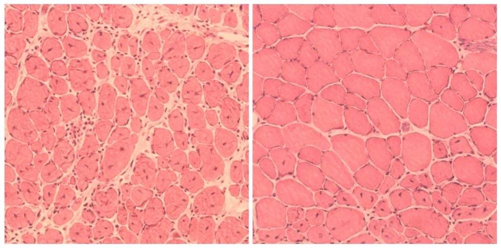 ▲经过治疗处理后，受损的肌肉细胞恢复能力变得更强（从左至右）（图片来源：参考资料[2]， credit:Salk Institute）<br label=图片备注 class=text-img-note>