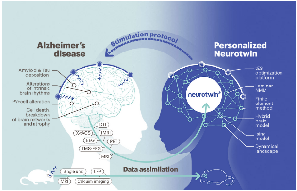 项目网站https://www.neurotwin.eu/ 以及网站上的示意图<br label=图片备注 class=text-img-note>