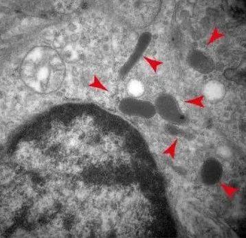 小鼠自发乳腺癌模型中存在胞内菌