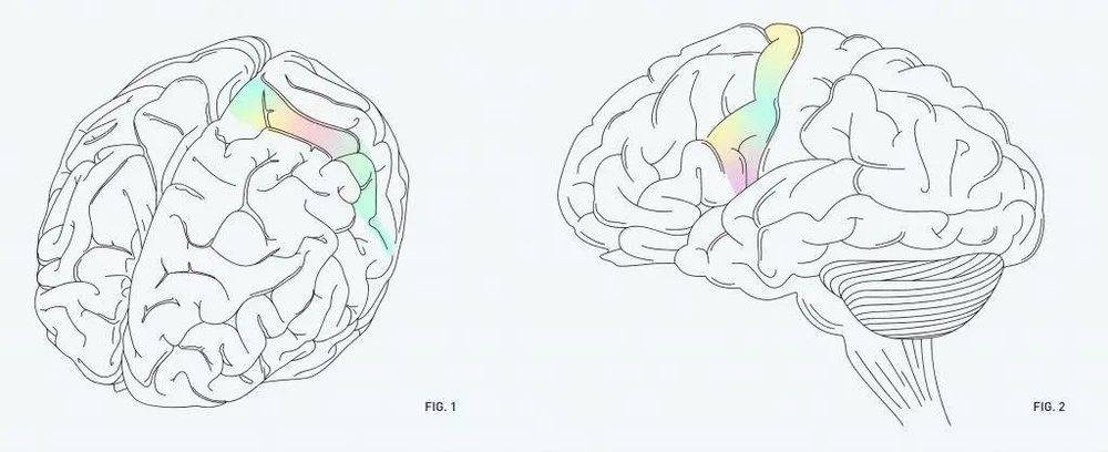 图片来自：Neuralink<br label=图片备注 class=text-img-note>