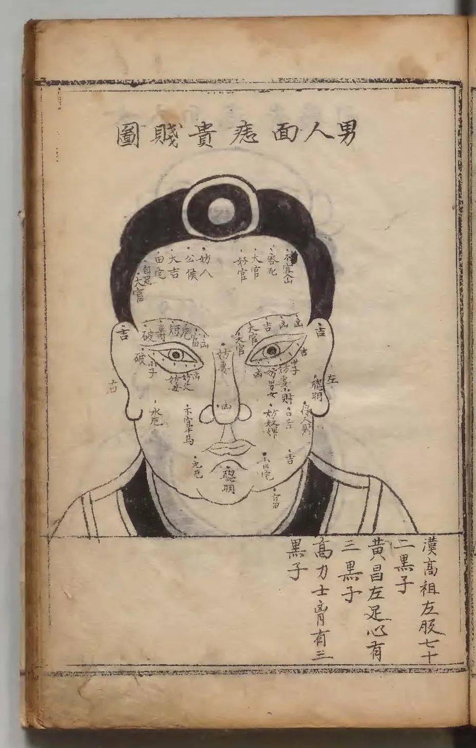 1590年朝鲜写本《新编相法五总龟》中的男人面痣贵贱图<br>
