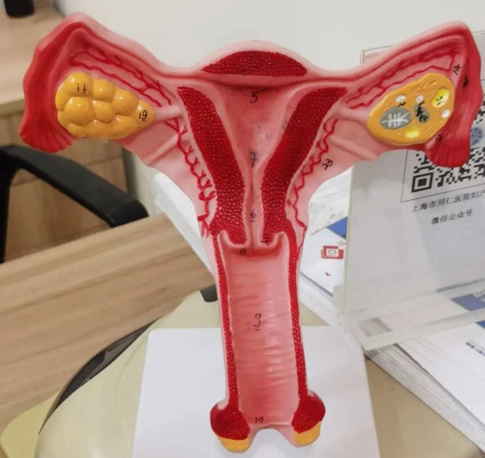 妇科诊室的子宫模型<br>