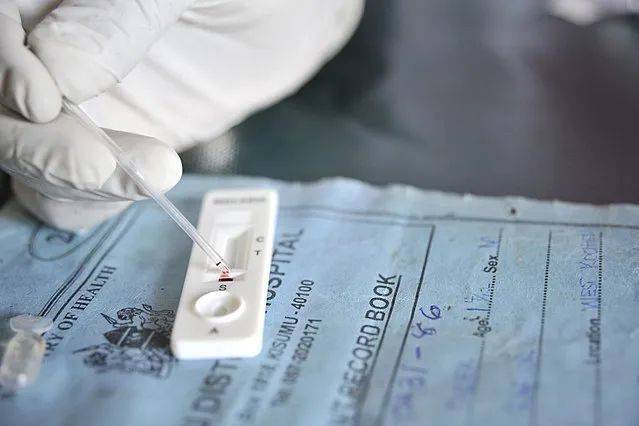 疟疾快速诊断测试 | USAID / Wikimedia Commons<br>